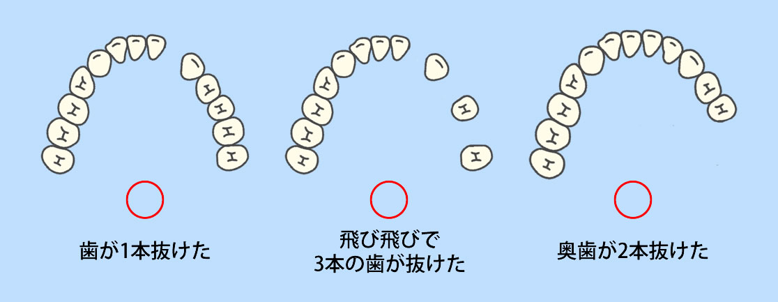 スマイルデンチャーはこんな方におすすめ